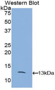CCL8 / MCP2 Antibody (aa20-94)