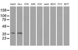 SORD / Sorbitol Dehydrogenase Antibody (clone OTI12A7)