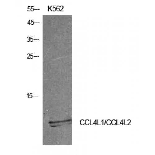 Polyclonal Rabbit anti-Human CCL4 / MIP-1 Beta Antibody (31-80 aa, Internal, WB)