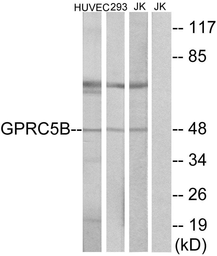 Polyclonal Rabbit anti-Human RAIG2 / GPRC5B Antibody (IF, WB)