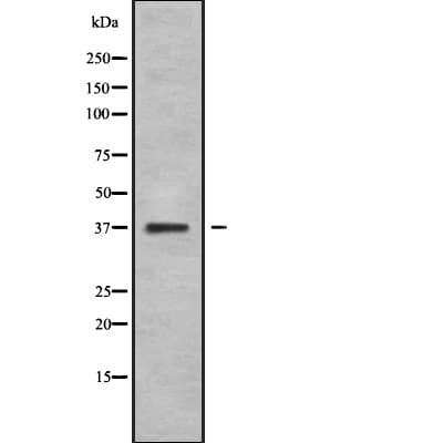 NEUROD4 Antibody