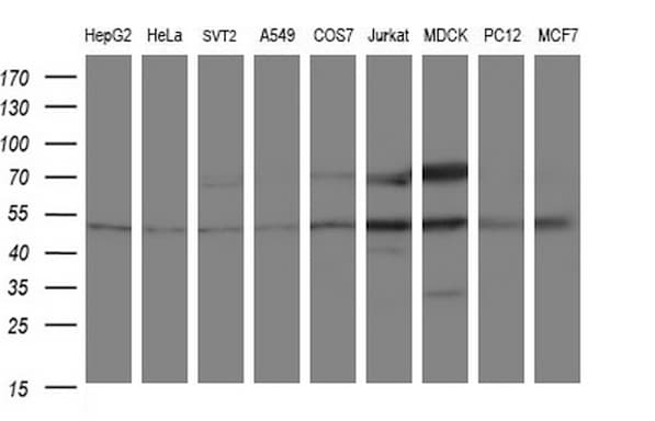 ANKMY2 Antibody (clone OTI1F11)