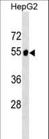GPT2 / ALT2 Antibody (aa15-44)