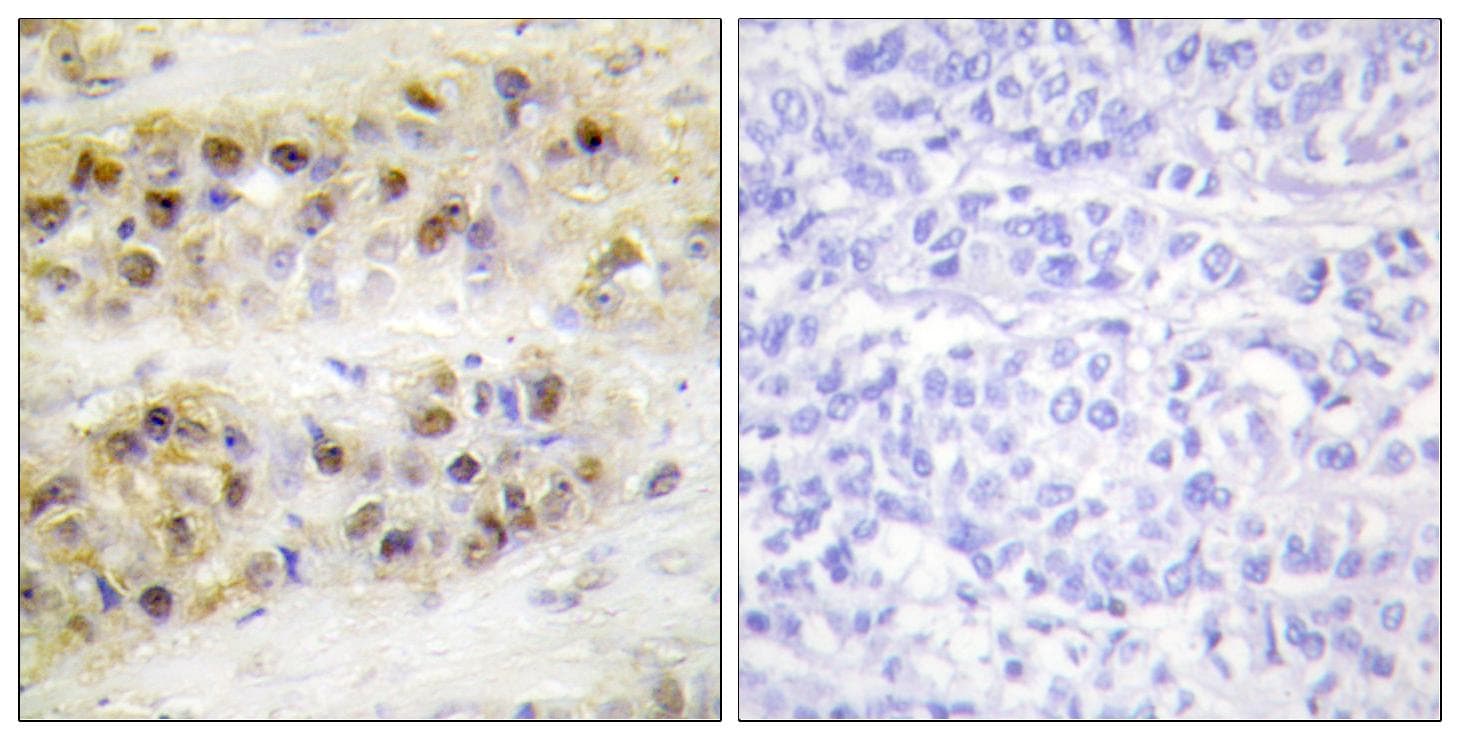 RORA / ROR Alpha Antibody