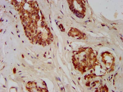 Polyclonal Rabbit anti-Human GMDS / GMD Antibody (IHC, IF)