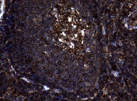 NME1 / NM23 Antibody (clone OTI6E8)