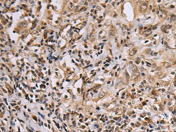 DNA2 Antibody
