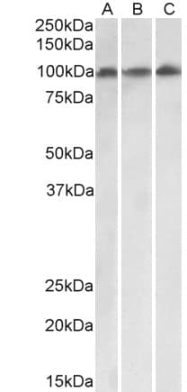 IHC-plus™ VPS16 Antibody (aa358-371)