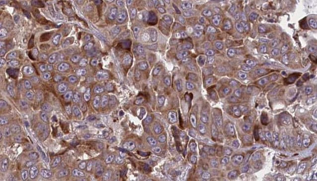 ATP1B1 Antibody