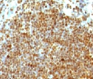 PCNA Antibody (clone PM441-1)