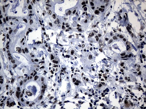 POLR2A / RNA polymerase II Antibody (aa1351-1614, clone OTI2B7)