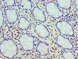 Polyclonal Rabbit anti-Human CCK / Cholecystokinin Antibody (aa21-115, IHC)