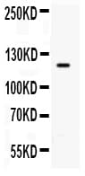 Polyclonal Rabbit anti-Rat TLR8 Antibody (aa1013-1029, WB)