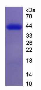 Human DHCR7 Protein (Recombinant)