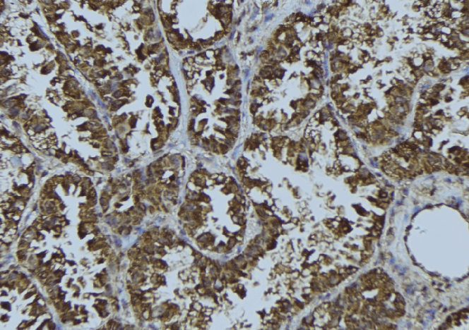 ERIC-1 / TACC3 Antibody