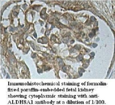 ALDH8A1 Antibody (aa287-487)