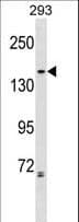 CAP-G2 / MTB Antibody (aa729-757)