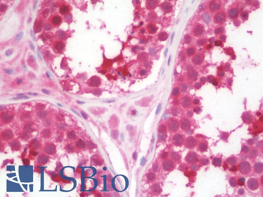 IHC-plus™ UCP1 / UCP-1 Antibody