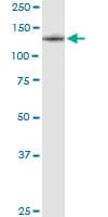 Monoclonal Mouse anti-Human CSF1R / CD115 / FMS Antibody (clone 1G4, WB)