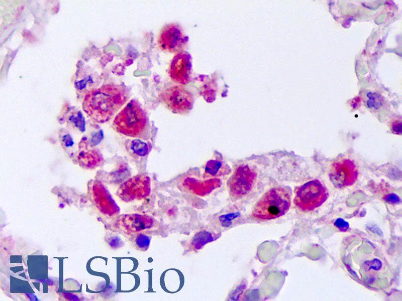 IHC-plus™ TNFSF10 / TRAIL Antibody