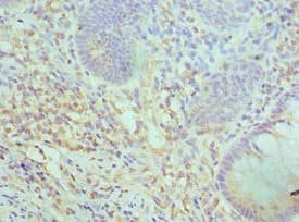 Polyclonal Rabbit anti-Human SMARCC2 Antibody (aa300-650, IHC, WB)