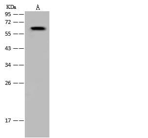 Polyclonal Rabbit anti-Human ARIH1 Antibody (WB)