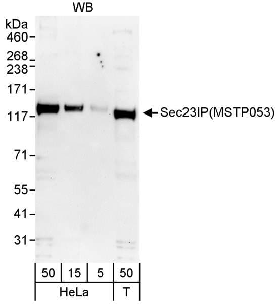 SEC23IP / p125 Antibody (aa350-400)