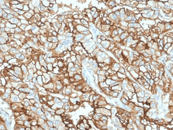 Monoclonal Mouse anti-Human MME / CD10 Antibody (clone MME/1870, IHC, WB)