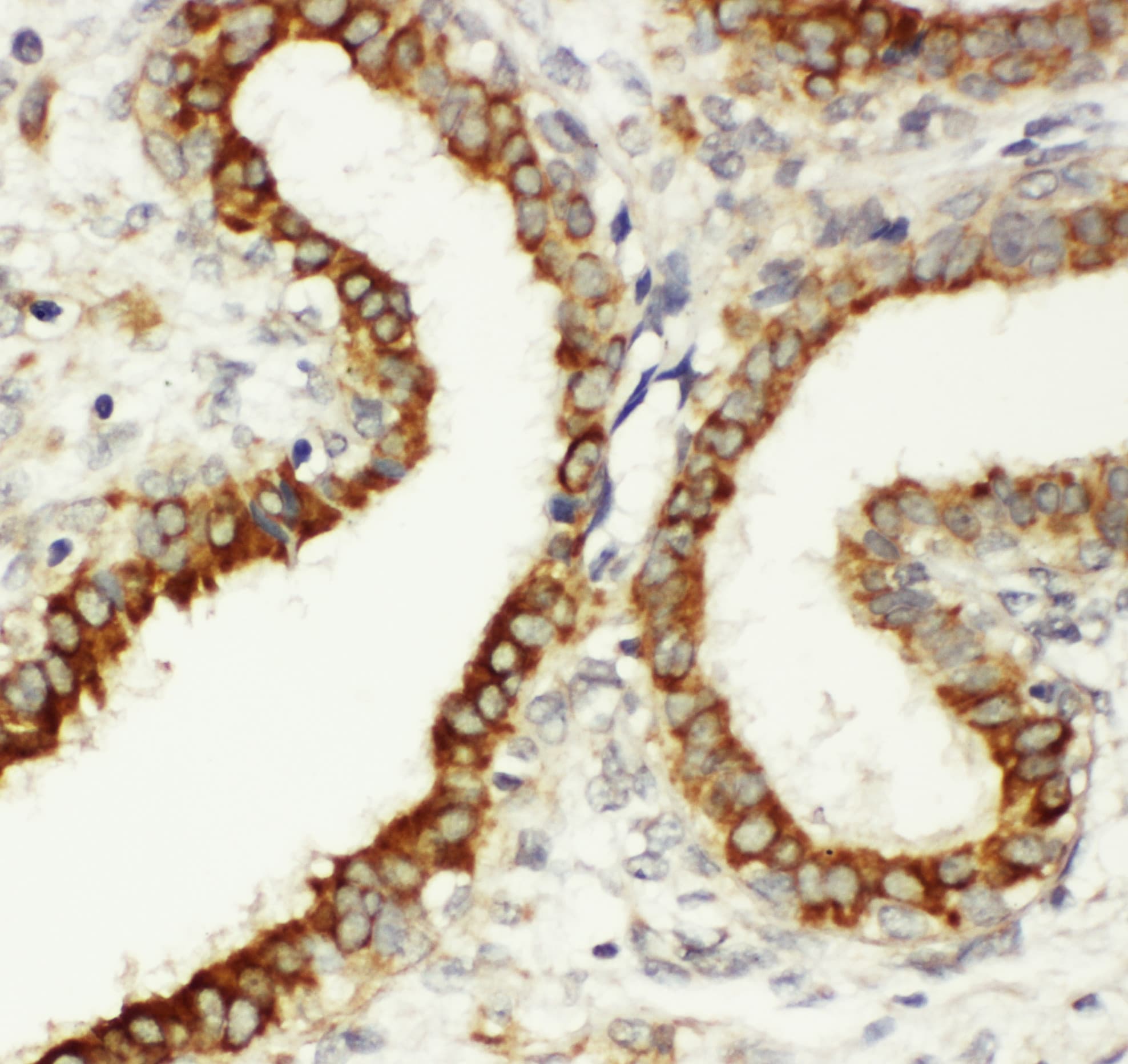 Polyclonal Rabbit anti-Human ITGB3 / Integrin Beta 3 / CD61 Antibody (aa752-770, IHC, WB)