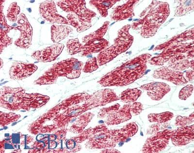 PathPlus™ ROR1 Antibody