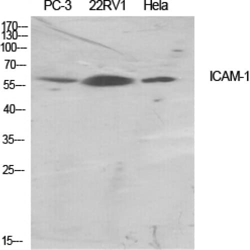 ICAM-1 / CD54 Antibody (450-530 aa)