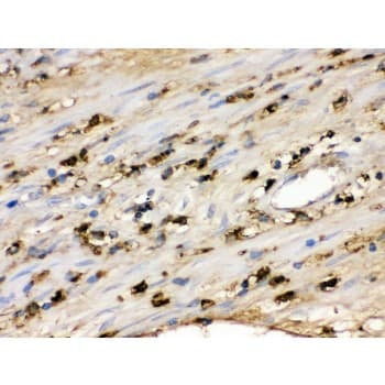Polyclonal Rabbit anti-Human S100A9 / MRP14 Antibody (aa2-114, IHC, WB)