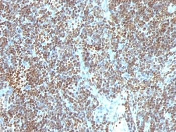 DNA ds Antibody (clone SPM603)