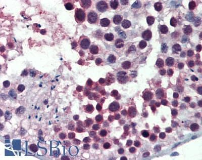 IHC-plus™ Polyclonal Rabbit anti-Human CCDC88A / GIV / Girdin Antibody (aa1425-1475, IHC, WB)