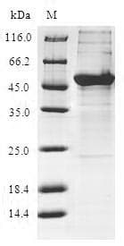 Human KCTD15 Protein (Recombinant GST, N-terminus)