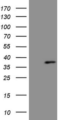 Monoclonal Mouse anti-Human PRPK / TP53RK Antibody (clone OTI5G7, IHC, WB)
