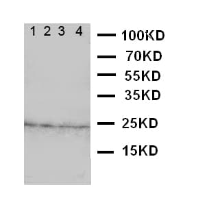 FGF22 Antibody (aa93-109)