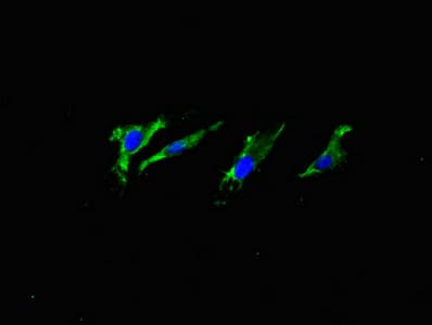 APP / Beta Amyloid Precursor Antibody (clone 5A11E5)