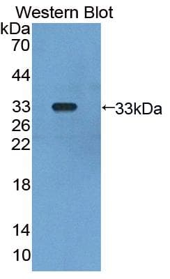 GLMN Antibody (aa294-549, PE)
