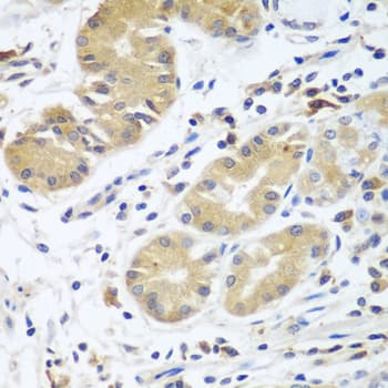 IHC-plus™ CFD / Factor D / Adipsin Antibody