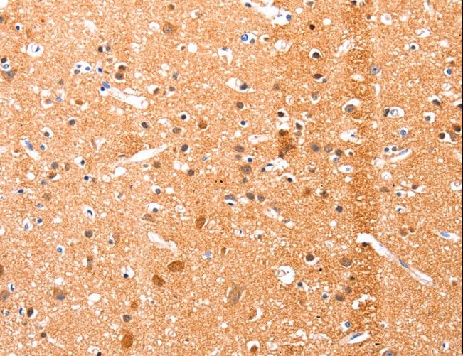 EFNA1 / Ephrin A1 Antibody