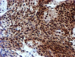 TIP48 / RUVBL2 Antibody (aa113-370, clone OTI1H10, Carrier-free)