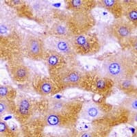 Polyclonal Rabbit anti-Human SHMT / SHMT2 Antibody (IHC, IF, WB)