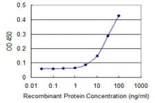 TUBB / Beta Tubulin Antibody (clone 3B3)