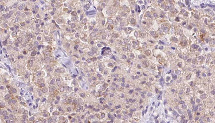 Polyclonal Rabbit anti-Human WSB1 Antibody (IHC, IF, WB)