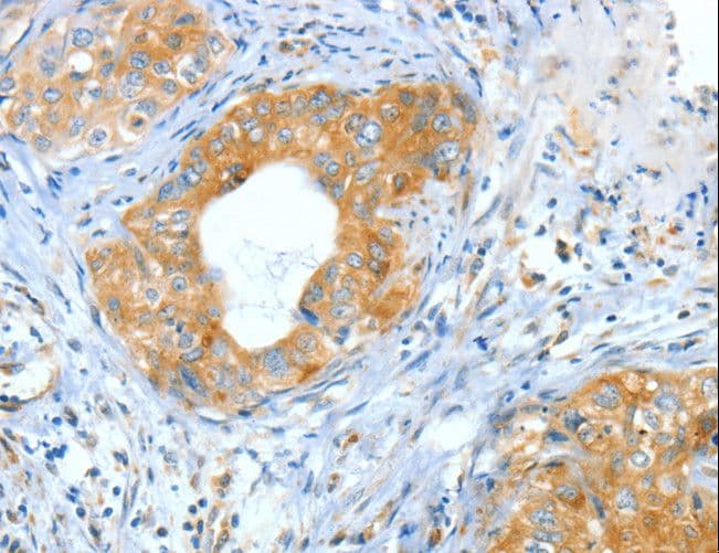 ASNS Antibody