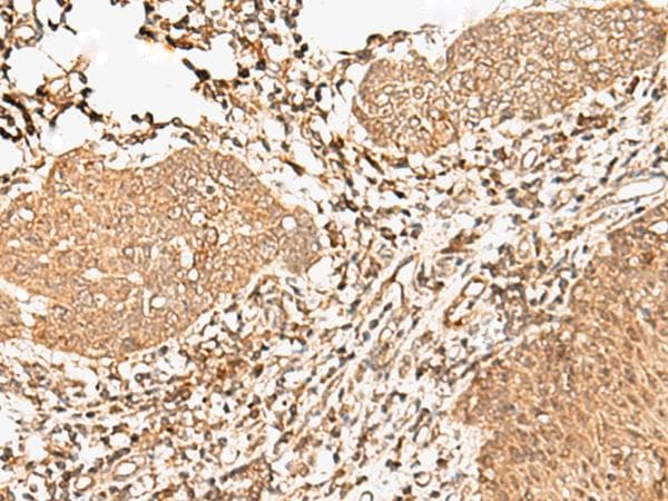 FER Antibody