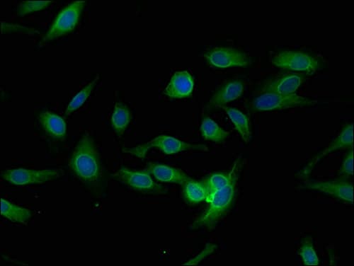 PLEKHO1 / CKIP-1 Antibody