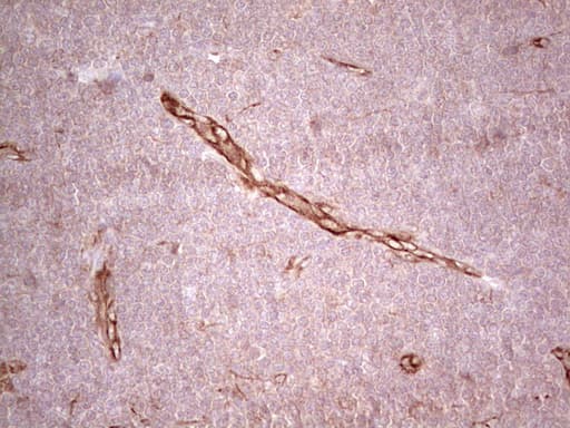 CFI / Complement Factor I Antibody (aa340-583, clone OTI17C5)