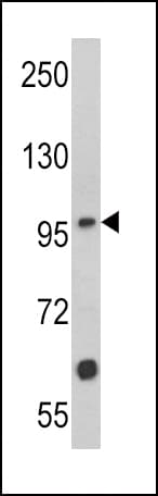 Polyclonal Rabbit anti-Human MUSK Antibody (aa35-65, IHC, WB)